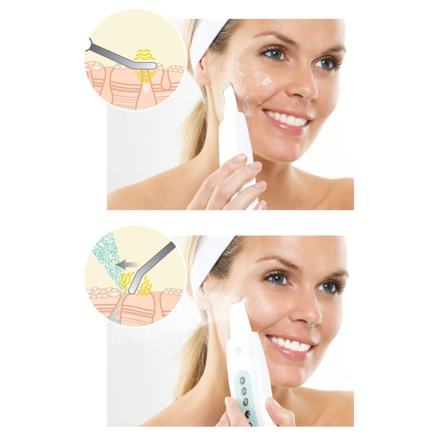 Rio Ultrasonic Facial Cleansing FASS3 Rio Ultrasonic Facial Cleansing FASS3