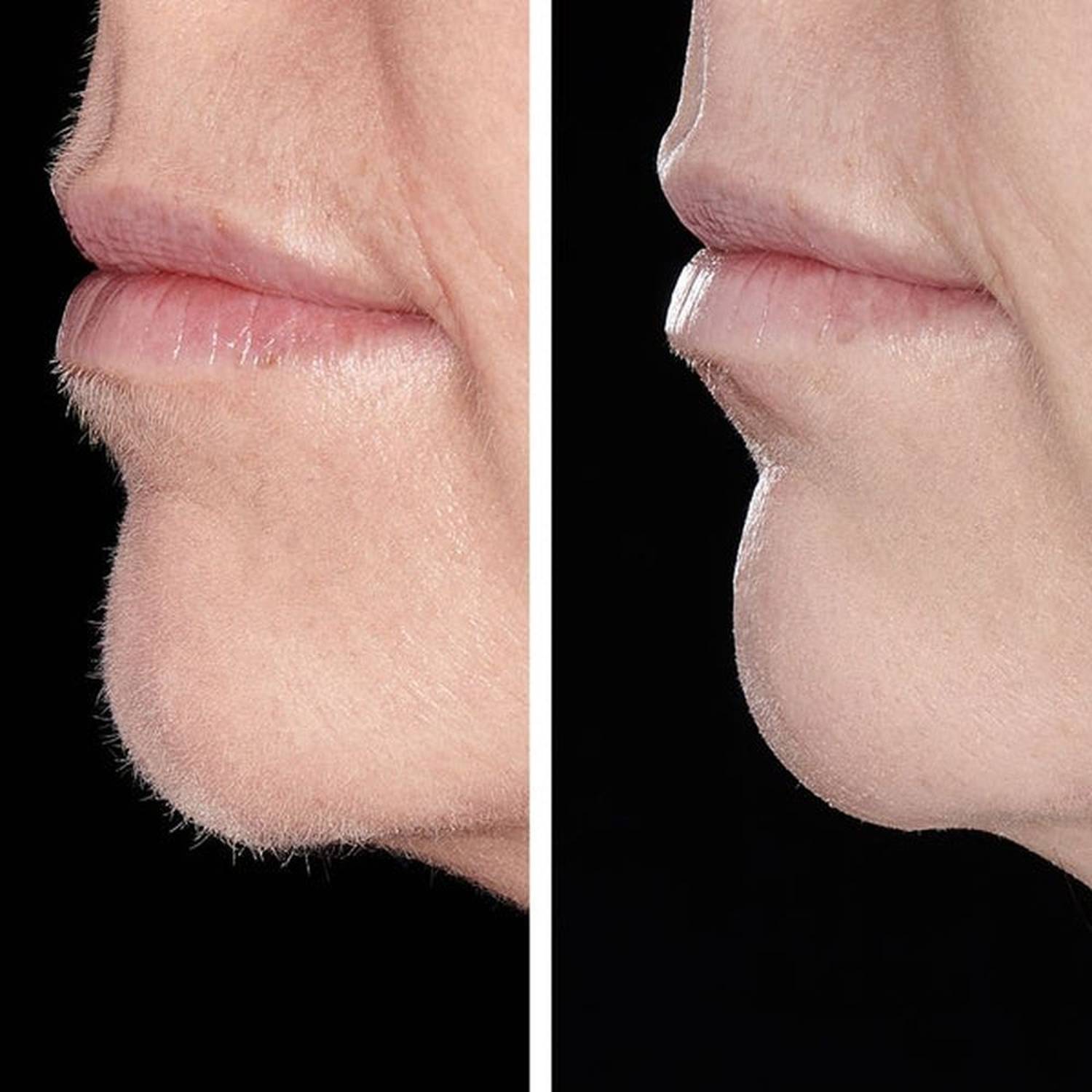 Hollywood Browzer Smoother 1 Head Rose Gold Hollywood Browzer Smoother 1 Head Rose Gold