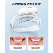 Fairywill Teeth Whitening Device With 14 Strips Fairywill Teeth Whitening Device With 14 Strips