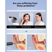 Bebird R1 Wireless Smart Visual Ear Stick With 1080p Otoscope Hd Camera & 6 Led Lights For Ear Cleaning 2 Silicone Ear Scoops Ear Cleaner 300w - Black